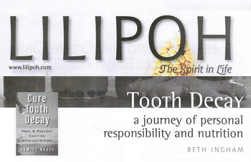 LiliPoh Tooth Decay Issue