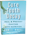 Tooth Decay Small Book Image