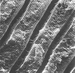 Tooth Dentine Microscopic