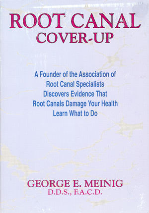 Root Canal Cover-Up