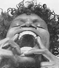 Aborignine Dental Arch