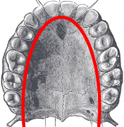 Well Formed Dental Arch