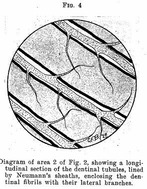 dentin tubules