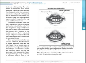 children's cavities ebook