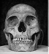 Weston Price Skulls No Tooth Cavities