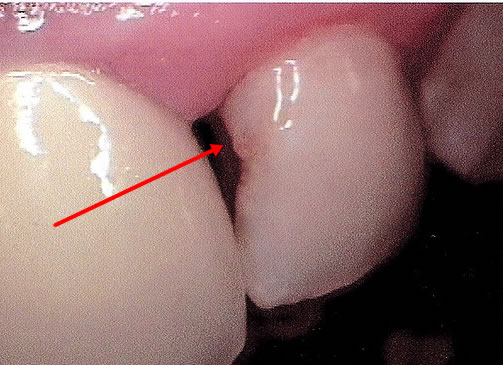 Large smooth surface decay